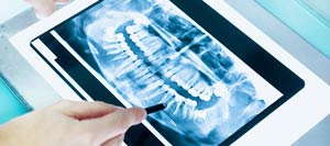 Dental X-Rays Specialist Near Me in Los Angeles, CA