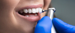 Teeth Cleaning Services Near Me in Los Angeles, CA