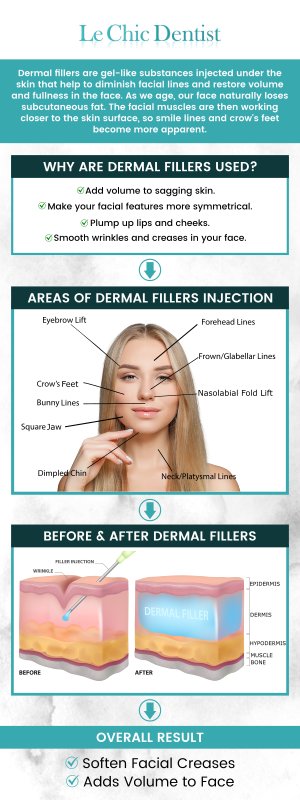At Le Chic Dentist, we specialize in advanced dental dermal filler treatments designed to enhance the beauty of your smile and restore natural facial contours. Our professional team provides personalized consultations to ensure your treatment is tailored to address dental concerns such as enhancing lip volume, smoothing out smile lines, or improving the appearance of the jawline. For more information, please contact us or schedule an appointment online. We are conveniently located at 3755 Sawtelle Blvd, Los Angeles, CA 90066. At Le Chic Dentist, we specialize in advanced dental dermal filler treatments designed to enhance the beauty of your smile and restore natural facial contours. Our professional team provides personalized consultations to ensure your treatment is tailored to address dental concerns such as enhancing lip volume, smoothing out smile lines, or improving the appearance of the jawline. For more information, please contact us or schedule an appointment online. We are conveniently located at 3755 Sawtelle Blvd, Los Angeles, CA 90066.