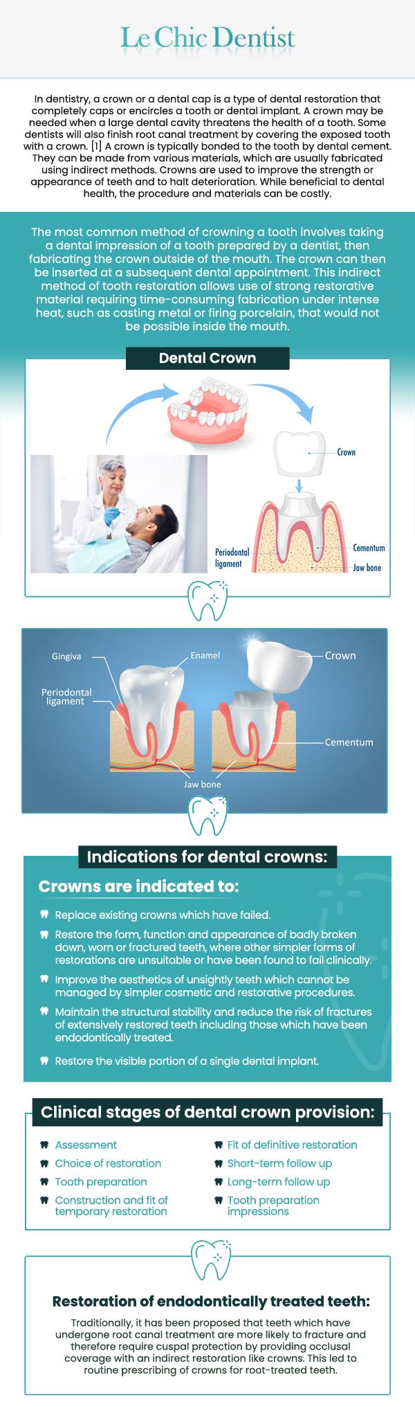 A single dental crown is a durable, custom-made restoration designed to protect and enhance a damaged or weakened tooth. At Le Chic Dentist, Dr. Maryam Hadian, DDS, offers beautifully crafted crowns that restore both function and aesthetics. Whether you have a cracked, decayed, or worn-down tooth, a single crown can help preserve your natural tooth structure while improving your smile’s appearance. Using advanced materials and precise digital technology, we ensure that every crown fits comfortably and blends seamlessly with your surrounding teeth. For more information, contact us today or schedule an appointment online. We are conveniently located at 3755 Sawtelle Blvd, Los Angeles, CA 90066. A single dental crown is a durable, custom-made restoration designed to protect and enhance a damaged or weakened tooth. At Le Chic Dentist, Dr. Maryam Hadian, DDS, offers beautifully crafted crowns that restore both function and aesthetics. Whether you have a cracked, decayed, or worn-down tooth, a single crown can help preserve your natural tooth structure while improving your smile’s appearance. Using advanced materials and precise digital technology, we ensure that every crown fits comfortably and blends seamlessly with your surrounding teeth. For more information, contact us today or schedule an appointment online. We are conveniently located at 3755 Sawtelle Blvd, Los Angeles, CA 90066.