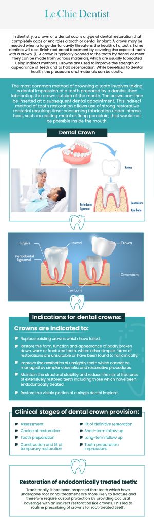 A single dental crown is a durable, custom-made restoration designed to protect and enhance a damaged or weakened tooth. At Le Chic Dentist, Dr. Maryam Hadian, DDS, offers beautifully crafted crowns that restore both function and aesthetics. Whether you have a cracked, decayed, or worn-down tooth, a single crown can help preserve your natural tooth structure while improving your smile’s appearance. Using advanced materials and precise digital technology, we ensure that every crown fits comfortably and blends seamlessly with your surrounding teeth. For more information, contact us today or schedule an appointment online. We are conveniently located at 3755 Sawtelle Blvd, Los Angeles, CA 90066. A single dental crown is a durable, custom-made restoration designed to protect and enhance a damaged or weakened tooth. At Le Chic Dentist, Dr. Maryam Hadian, DDS, offers beautifully crafted crowns that restore both function and aesthetics. Whether you have a cracked, decayed, or worn-down tooth, a single crown can help preserve your natural tooth structure while improving your smile’s appearance. Using advanced materials and precise digital technology, we ensure that every crown fits comfortably and blends seamlessly with your surrounding teeth. For more information, contact us today or schedule an appointment online. We are conveniently located at 3755 Sawtelle Blvd, Los Angeles, CA 90066.
