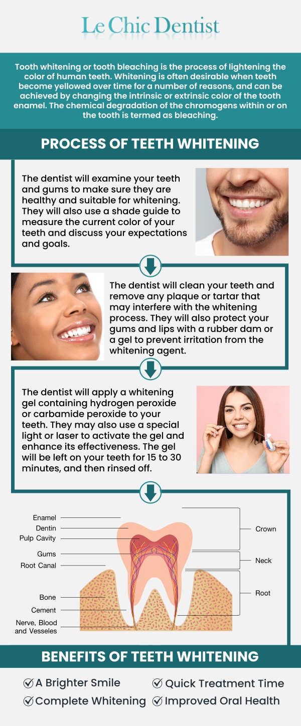 Choosing professional teeth whitening offers more than just a brighter smile. It ensures safe, consistent, and lasting results compared to over-the-counter options. At Le Chic Dentist, our skilled team uses advanced whitening techniques that minimize tooth sensitivity and protect enamel health. Patients also benefit from a customized approach, where whitening treatments are tailored to individual needs, ensuring a natural look that enhances overall confidence. For more information, please contact us or schedule an appointment online. We are conveniently located at 3755 Sawtelle Blvd, Los Angeles, CA 90066.