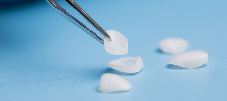 Where to Get Porcelain Veneers in Santa Monica, CA?